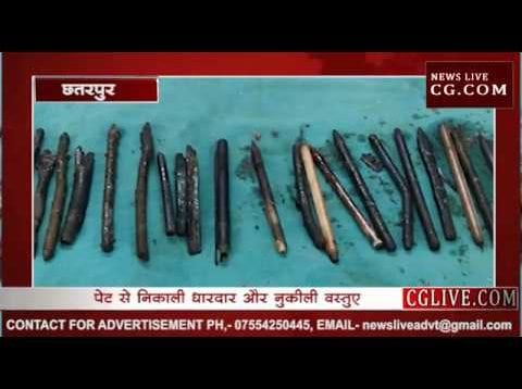 पेट से निकली चाकू, पेंचकस, सूजे और ब्लेड जैसी खतरनाक चीजें, दो घंटे चला ऑपरेशन