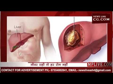world hepititis day – जानिए कैसे रखें अपने लीवर को स्वस्थ