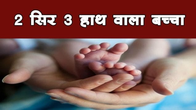 MP में जन्म 2 सिर 3 हाथ वाला बच्चा