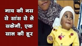चमत्कार बच्ची के लिवर में लगाईं गाय की नसें, ऐसे हुआ ट्रांसप्लांट
