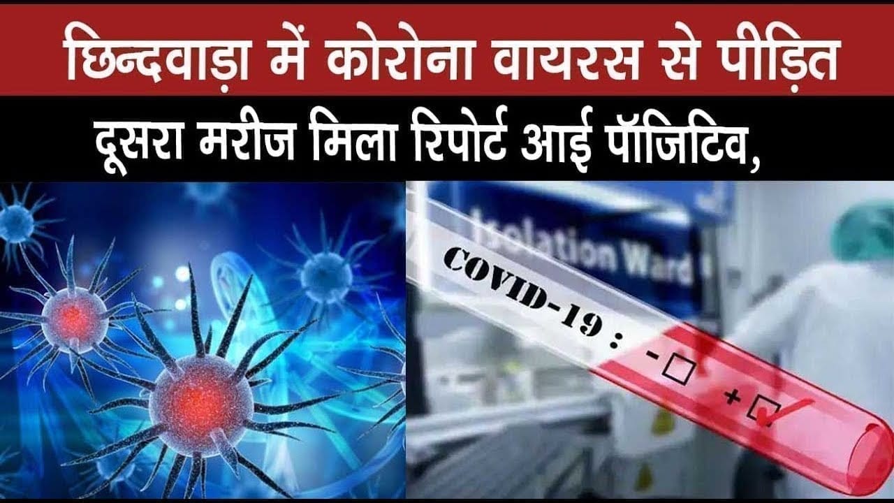 छिन्दवाड़ा में कोरोना वायरस से पीड़ित दूसरा मरीज मिला रिपोर्ट आई पॉजिटिव,