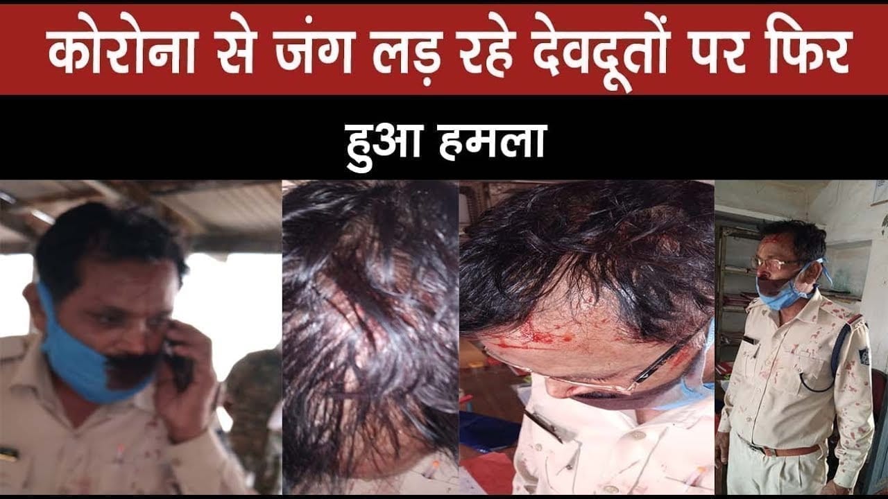 Sheopur में इंसानियत शर्मसार, कोरोना वारियर पर हमला