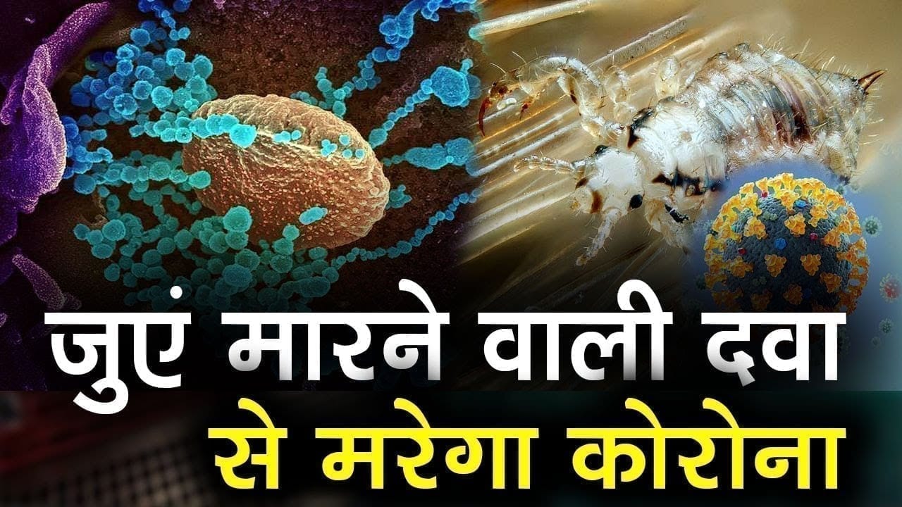 बालों में होने वाले जुएं मारने की दवा से होगा कोरोना का इलाज! शुरू हो चुका है क्लीनिकल ट्रायल