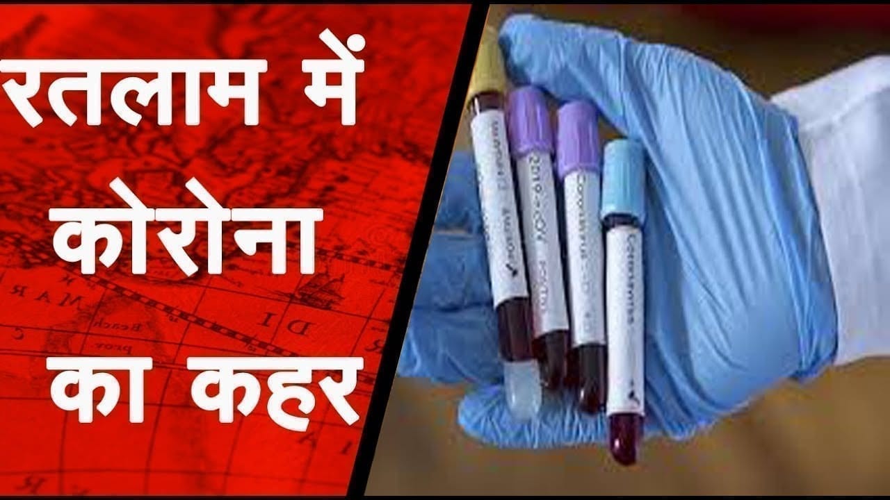 बाबा ने बांटा 23 लोगों को संक्रमण, रतलाम में अब 85 पॉजिटिव
